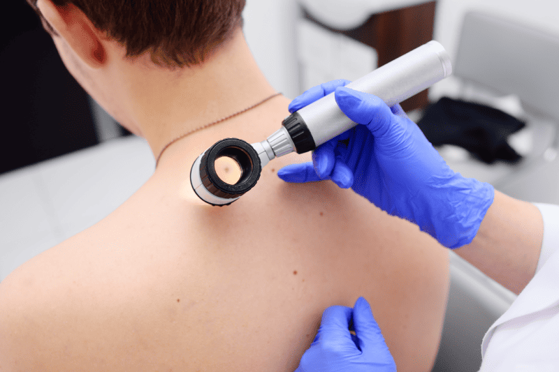 The dermatologist examines the moles or acne of the patient with a dermatoscope | Adam J Cohen, MD in Glenview & Chicago, IL