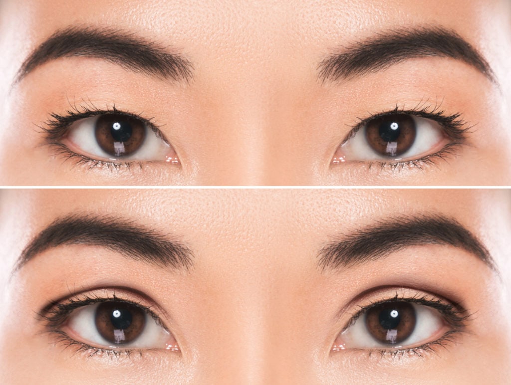 Close-up of female eyes after East Asian blepharoplasty or double eyelid surgery | Adam J Cohen, MD in Glenview & Chicago, IL