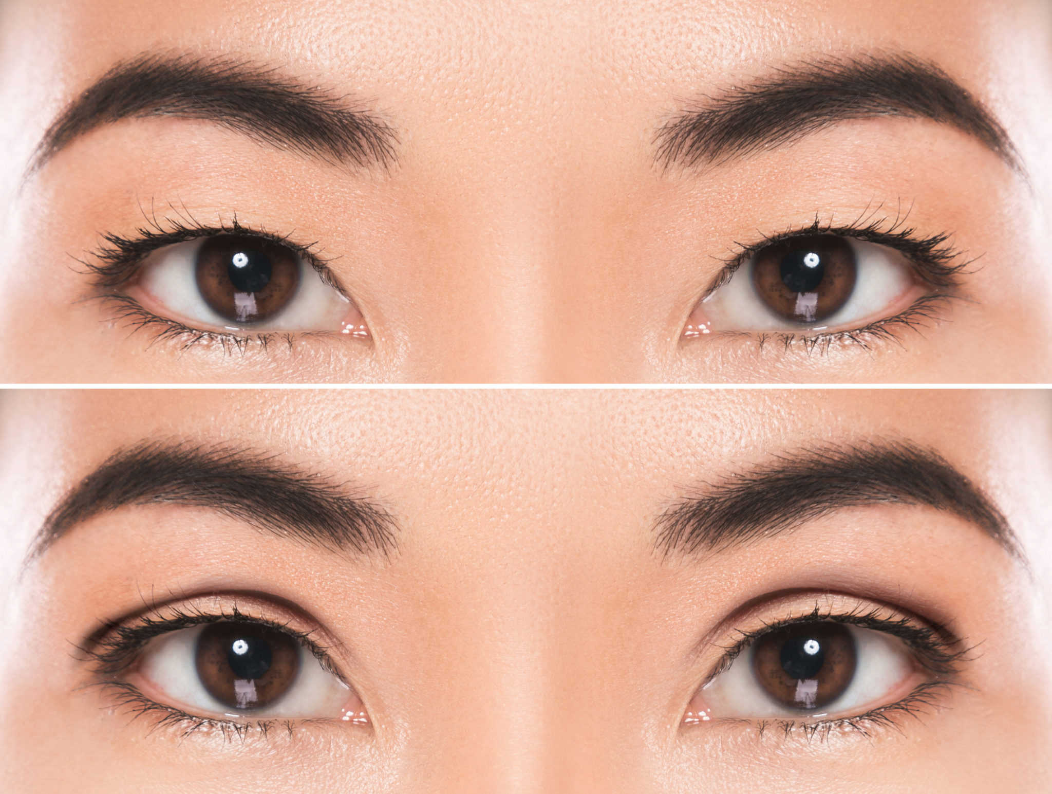 why-eyelid-surgery-might-be-right-for-you-adam-j-cohen-md