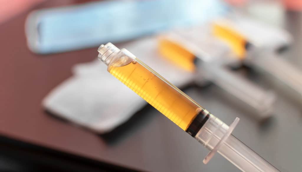 Blood plasma in a syringe on a blurred background. Blood plasma as a solution for the treatment of coronavirus. Platelet-rich plasma preparation for plasmolifting therapy. Selective focus | Adam J Cohen, MD in Glenview & Chicago, IL