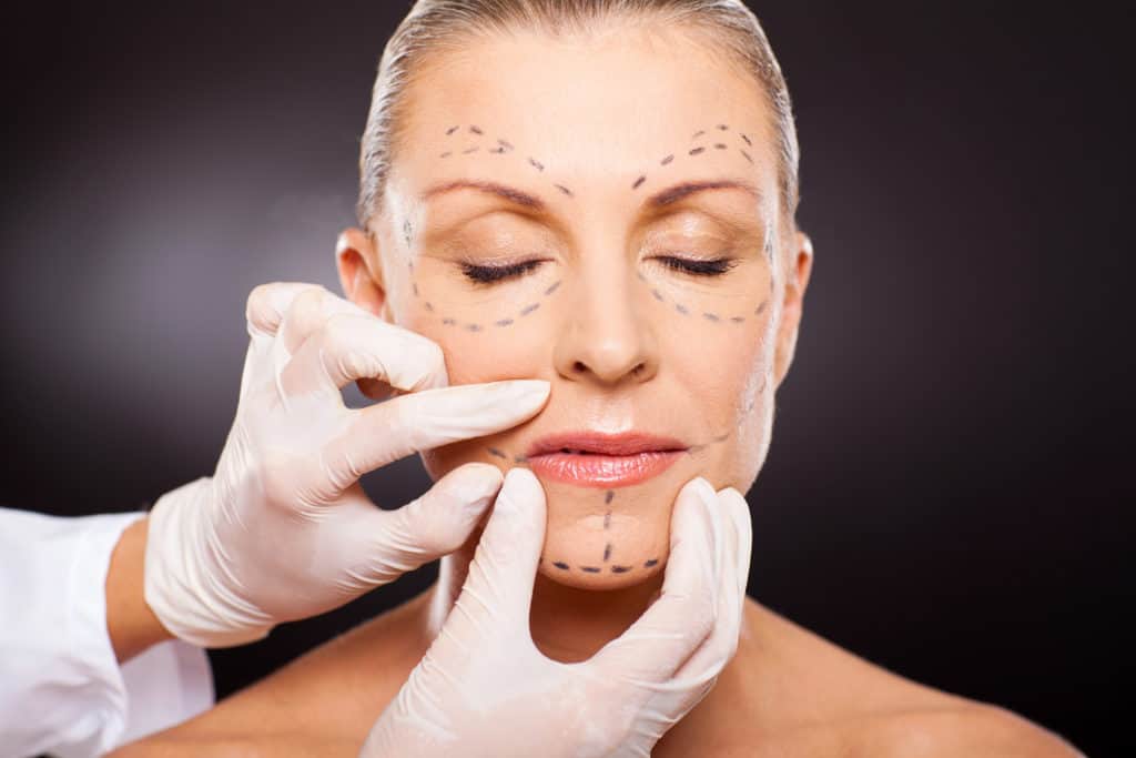 Revitalize Your Appearance with a Mid Facelift A Comprehensive Guide