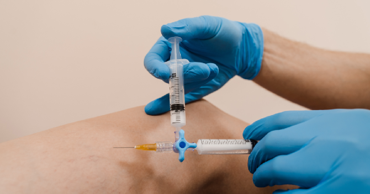 Vascular Laser Therapy in Chicago